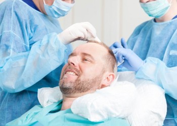 hair transplant